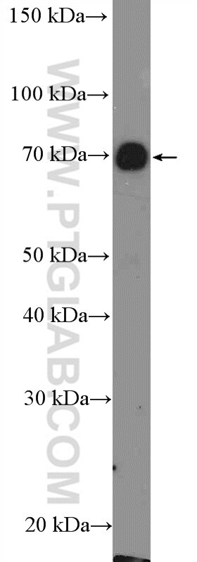 Western Blot (WB) analysis of rat brain tissue using CPT1C-specific Polyclonal antibody (12969-1-AP)