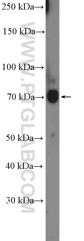 Western Blot (WB) analysis of HeLa cells using CPT1C-specific Polyclonal antibody (12969-1-AP)
