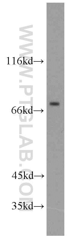 Western Blot (WB) analysis of mouse brain tissue using CPT1C-specific Polyclonal antibody (12969-1-AP)
