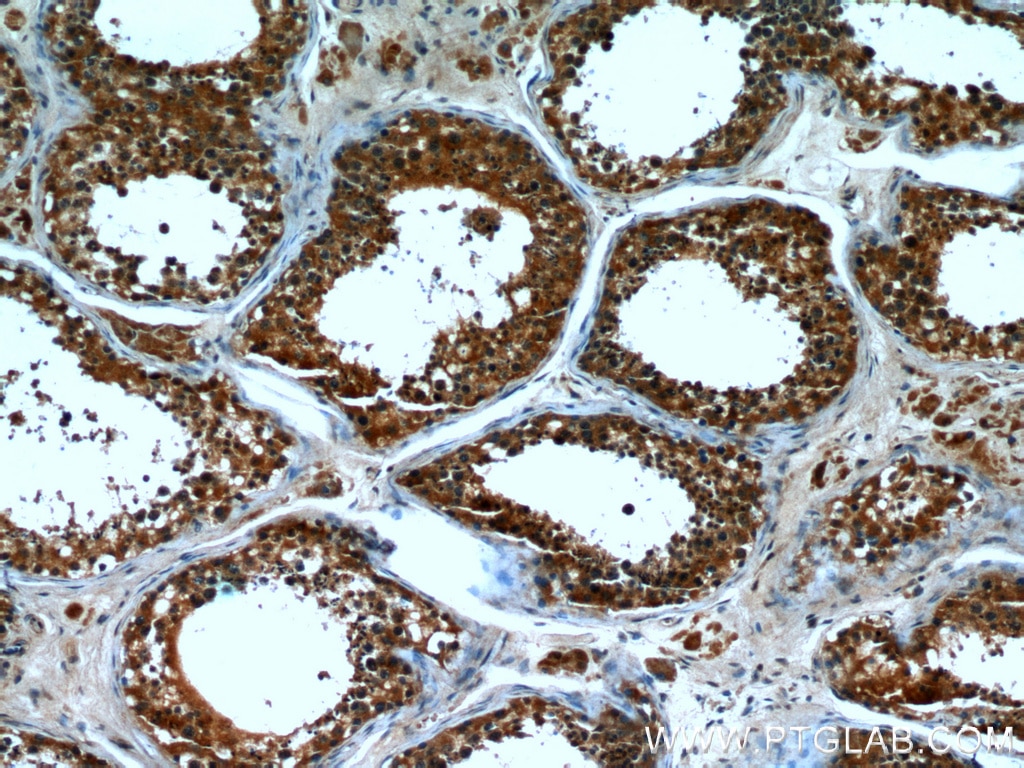 Immunohistochemistry (IHC) staining of human testis tissue using CPT1C Monoclonal antibody (66072-1-Ig)