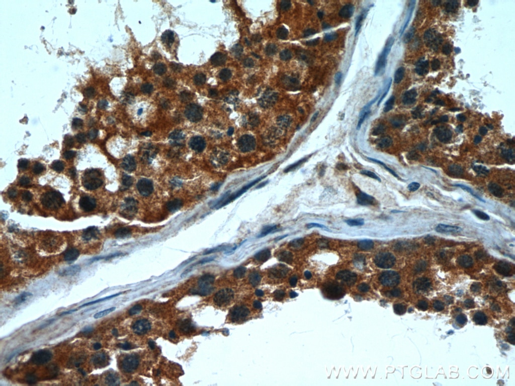 Immunohistochemistry (IHC) staining of human testis tissue using CPT1C Monoclonal antibody (66072-1-Ig)