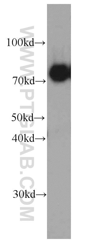 Western Blot (WB) analysis of human brain tissue using CPT1C Monoclonal antibody (66072-1-Ig)