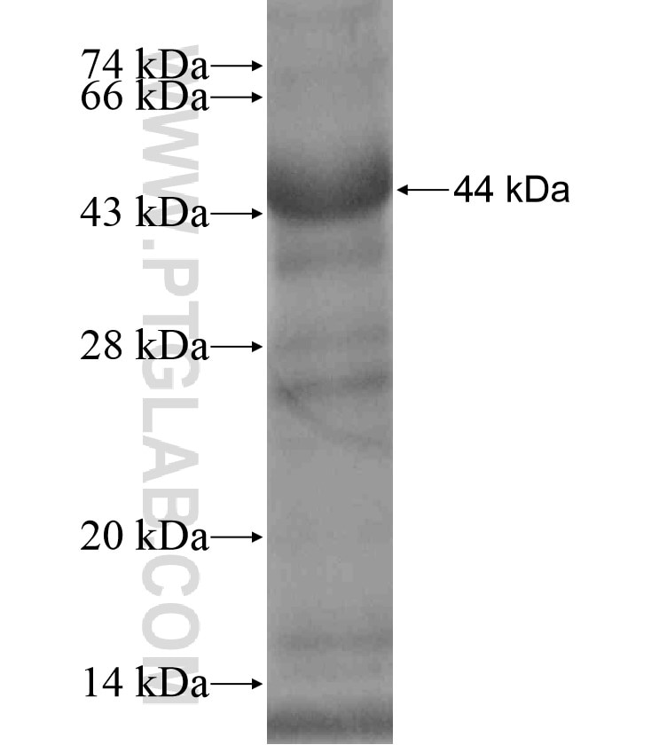 CPT1C fusion protein Ag17963 SDS-PAGE