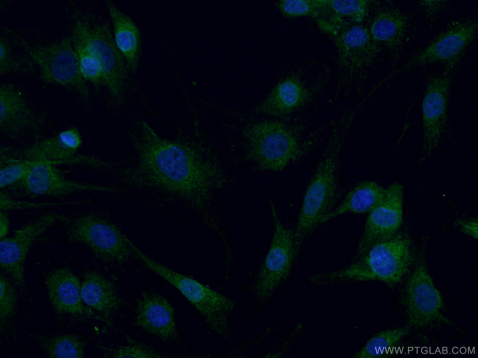 Immunofluorescence (IF) / fluorescent staining of C2C12 cells using CPT2 Polyclonal antibody (26555-1-AP)