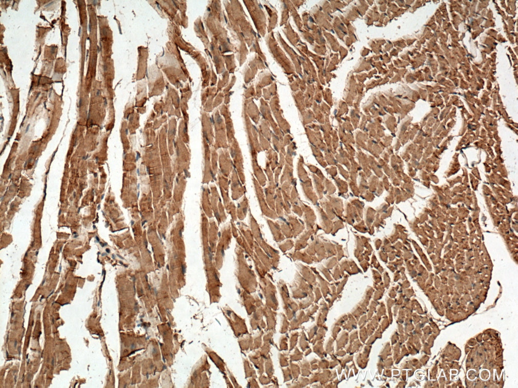 Immunohistochemistry (IHC) staining of mouse heart tissue using CPT2 Polyclonal antibody (26555-1-AP)