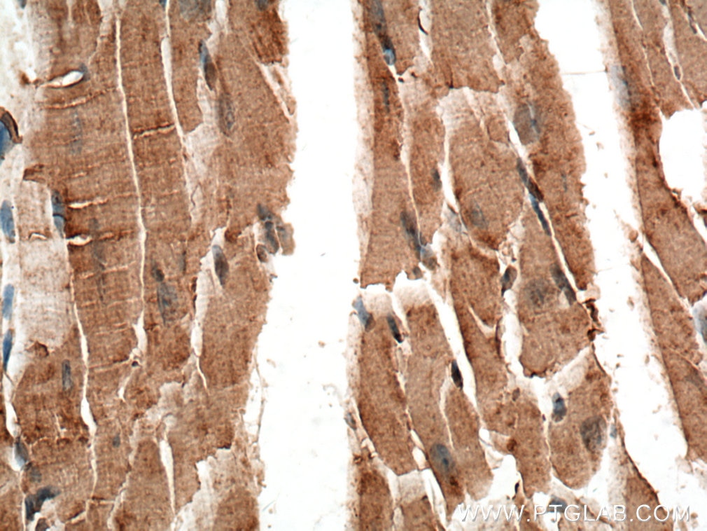 Immunohistochemistry (IHC) staining of mouse heart tissue using CPT2 Polyclonal antibody (26555-1-AP)