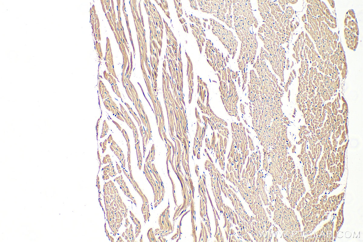 Immunohistochemistry (IHC) staining of mouse heart tissue using CPT2 Polyclonal antibody (26555-1-AP)