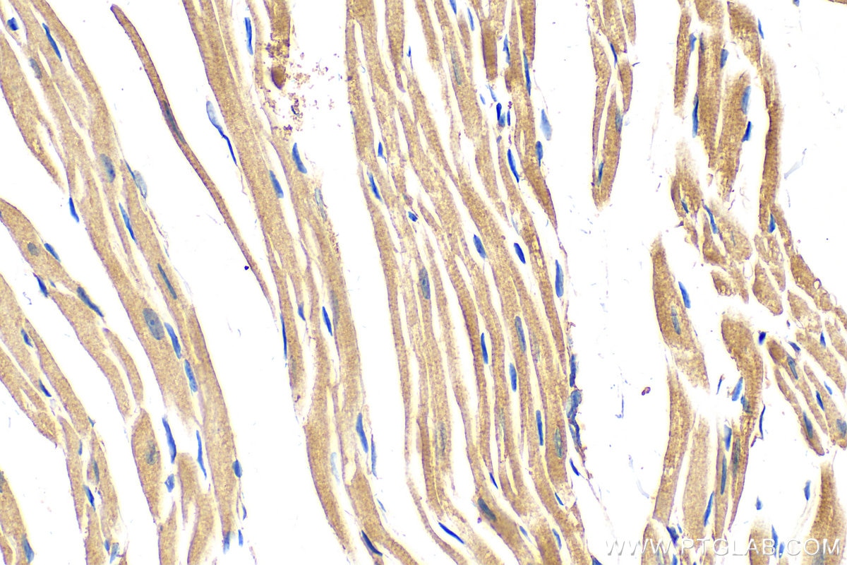 Immunohistochemistry (IHC) staining of mouse heart tissue using CPT2 Polyclonal antibody (26555-1-AP)