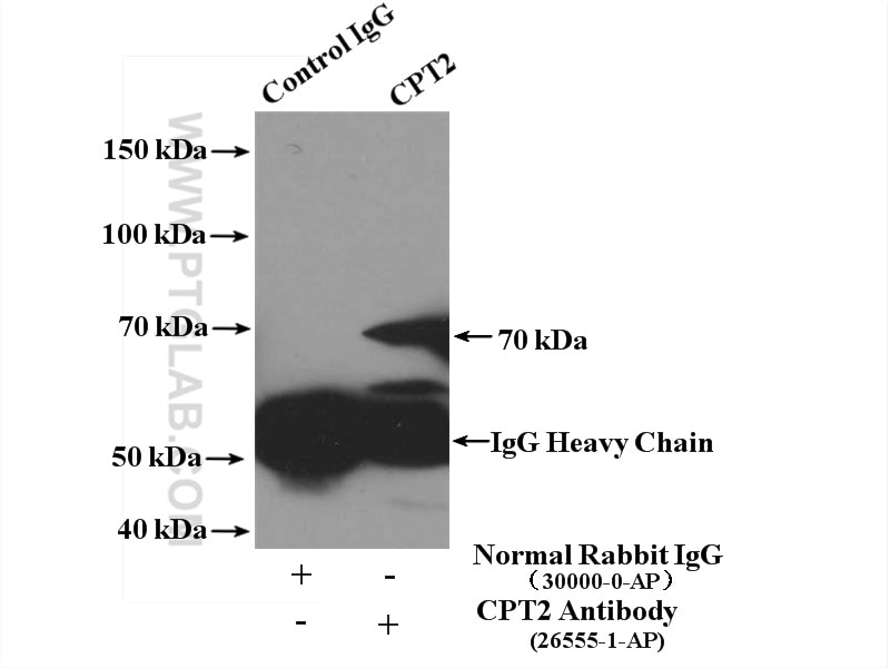 Immunoprecipitation (IP) experiment of mouse liver tissue using CPT2 Polyclonal antibody (26555-1-AP)