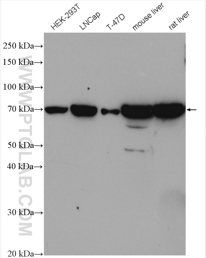 Western Blot (WB) analysis of various lysates using CPT2 Polyclonal antibody (26555-1-AP)