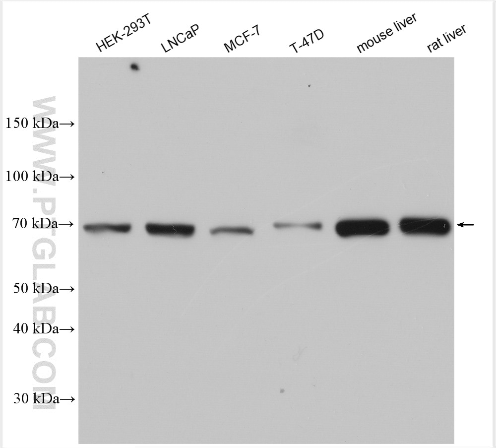 Western Blot (WB) analysis of various lysates using CPT2 Polyclonal antibody (26555-1-AP)