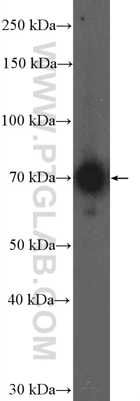Western Blot (WB) analysis of mouse heart tissue using CPT2 Polyclonal antibody (26555-1-AP)