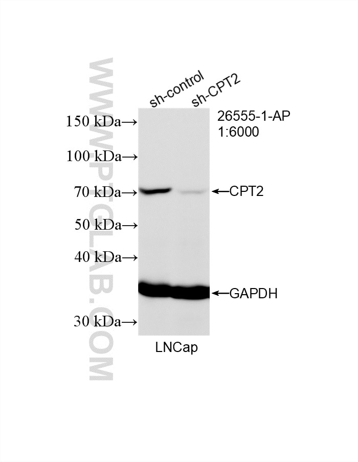 Western Blot (WB) analysis of LNCaP cells using CPT2 Polyclonal antibody (26555-1-AP)