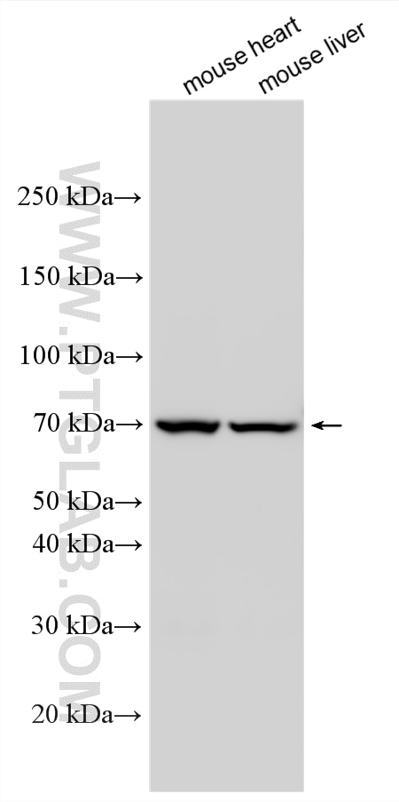WB analysis using 26555-1-AP Western Blot (WB) analysis of various lysates using CPT2 Polyclonal antibody (26555-1-AP)