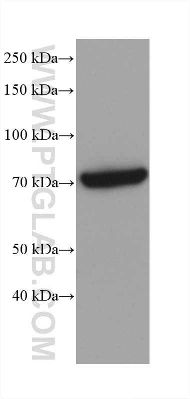 WB analysis of rat liver using 68815-3-Ig Western Blot (WB) analysis of rat liver tissue using CPT2 Monoclonal antibody (68815-3-Ig)