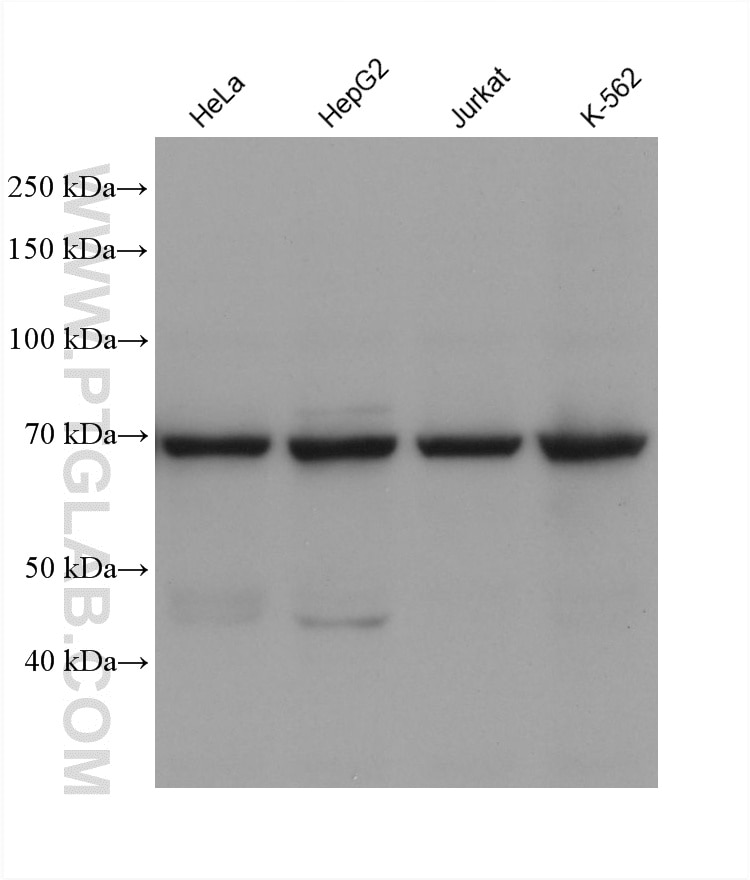 WB analysis using 68815-3-Ig Western Blot (WB) analysis of various lysates using CPT2 Monoclonal antibody (68815-3-Ig)