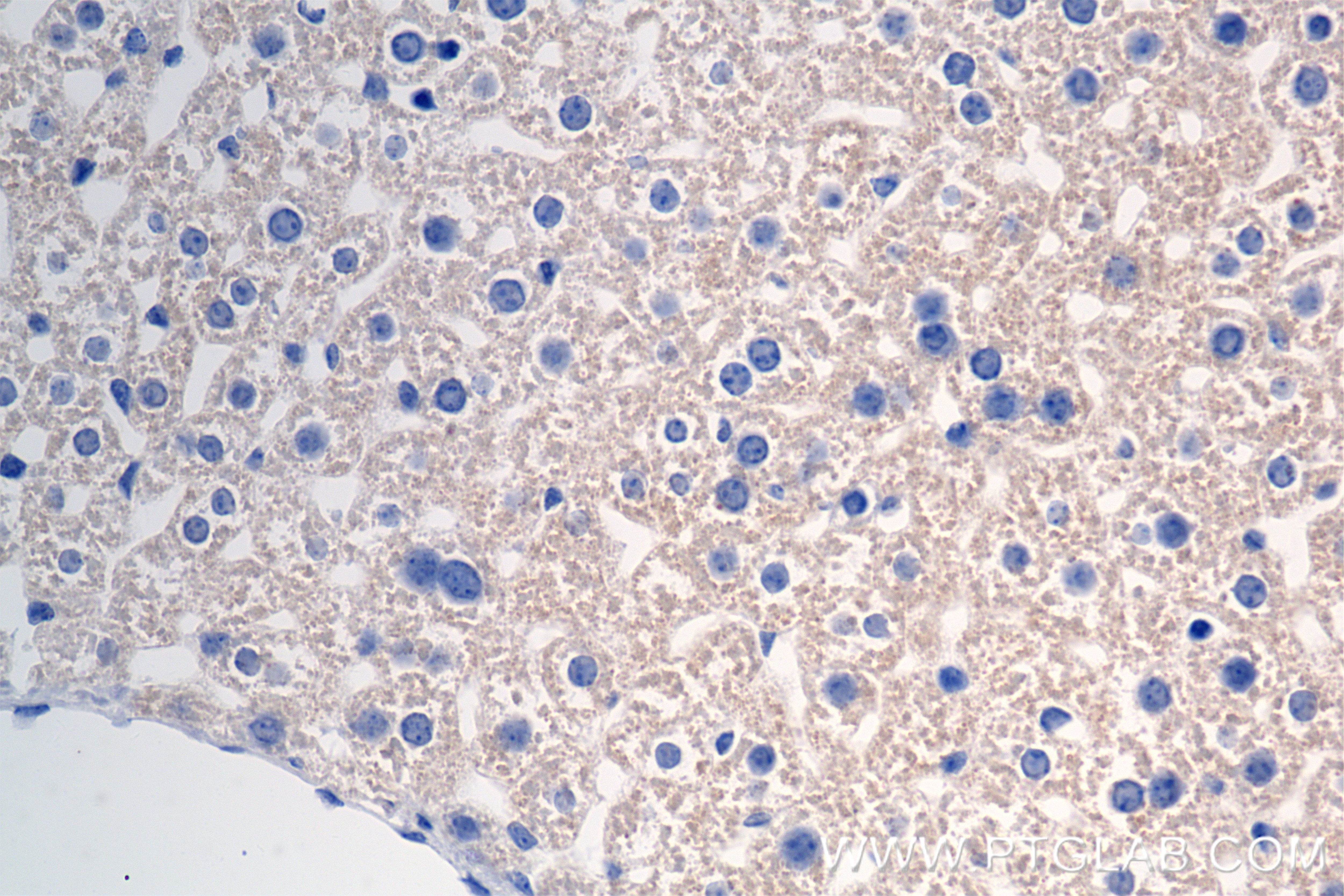 Immunohistochemistry (IHC) staining of mouse liver tissue using CPT2 Recombinant antibody (85013-4-RR)