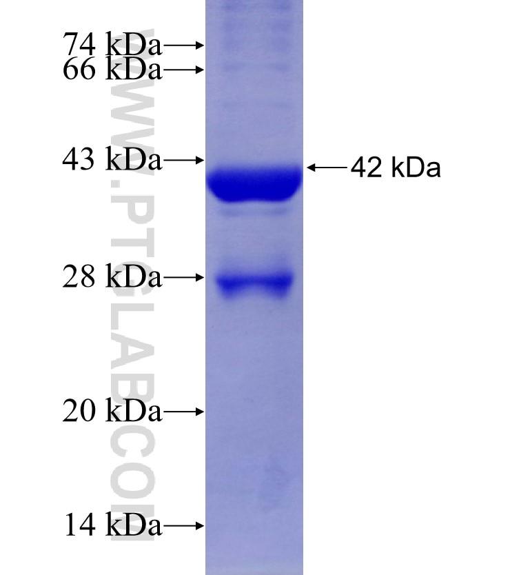 CPT2 fusion protein Ag24897 SDS-PAGE