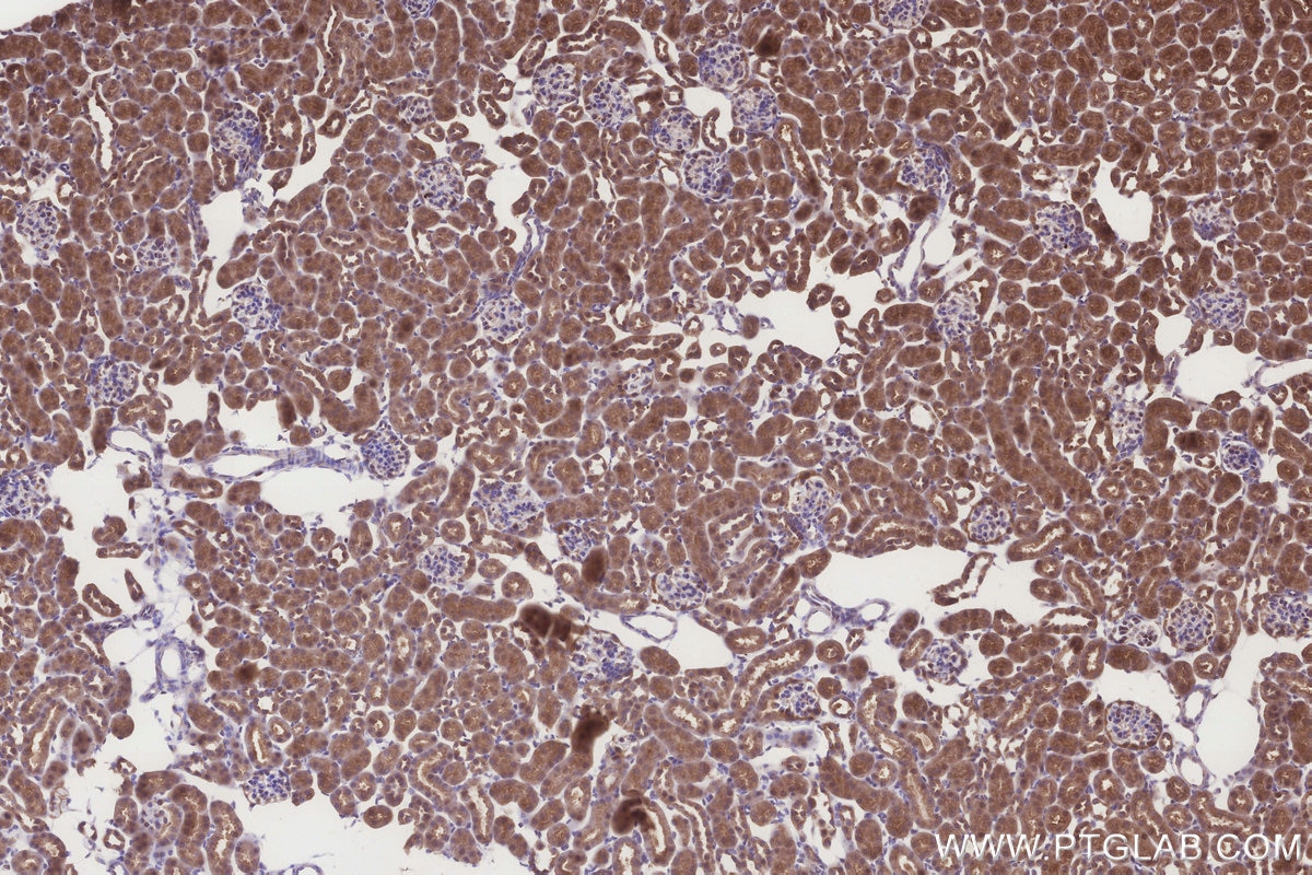 IHC staining of mouse kidney using 33114-1-AP Immunohistochemistry (IHC) staining of mouse kidney tissue using CPTP Polyclonal antibody (33114-1-AP)