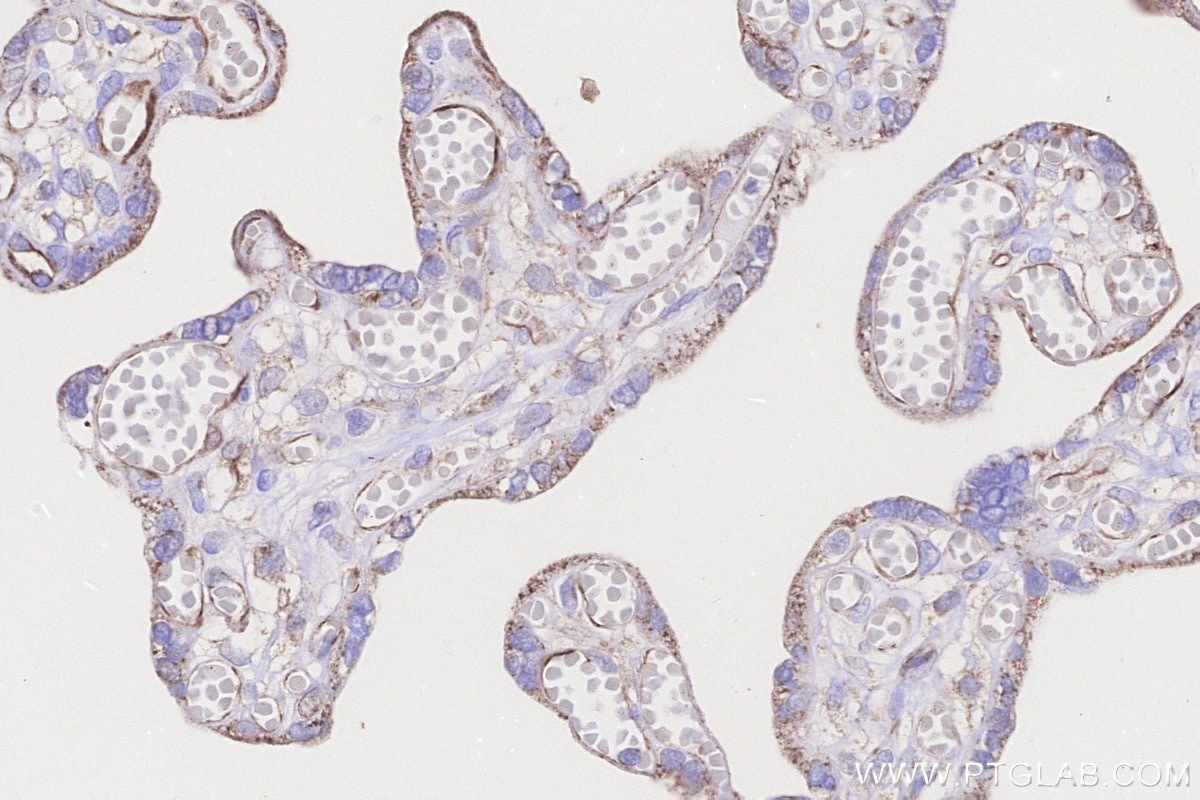 IHC staining of human placenta using 33114-1-AP Immunohistochemistry (IHC) staining of human placenta tissue using CPTP Polyclonal antibody (33114-1-AP)
