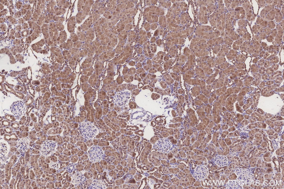 IHC staining of rat kidney using 33114-1-AP Immunohistochemistry (IHC) staining of rat kidney tissue using CPTP Polyclonal antibody (33114-1-AP)