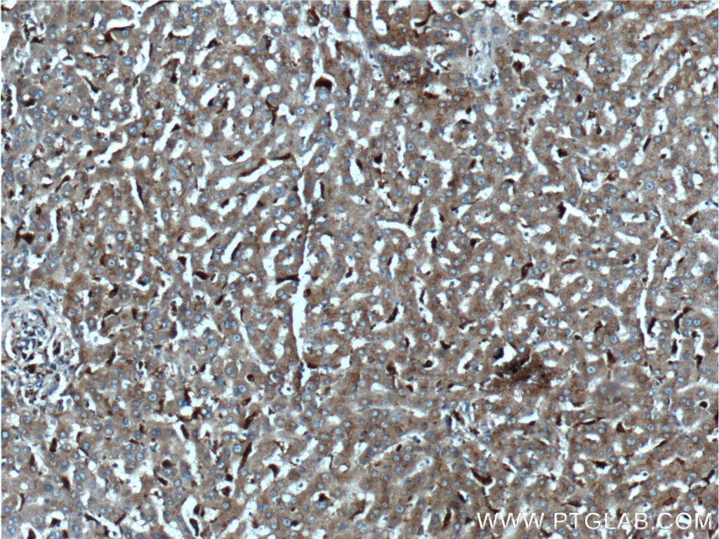 Immunohistochemistry (IHC) staining of human liver tissue using CPVL Polyclonal antibody (12548-1-AP)