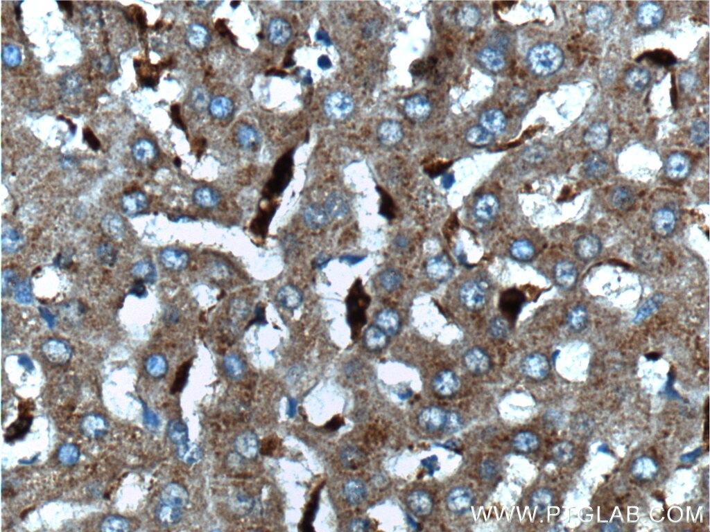 Immunohistochemistry (IHC) staining of human liver tissue using CPVL Polyclonal antibody (12548-1-AP)