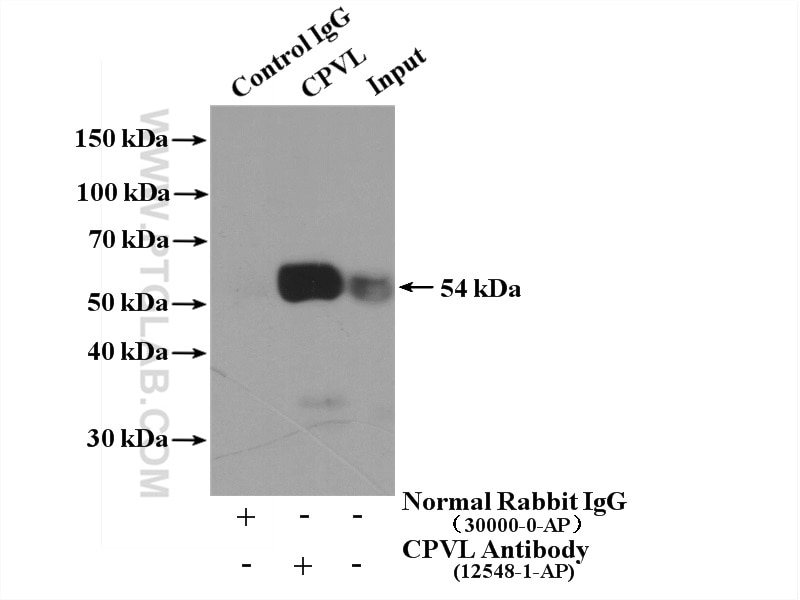 Immunoprecipitation (IP) experiment of HEK-293 cells using CPVL Polyclonal antibody (12548-1-AP)