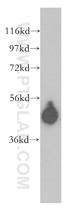Western Blot (WB) analysis of human heart tissue using CPVL Polyclonal antibody (12548-1-AP)