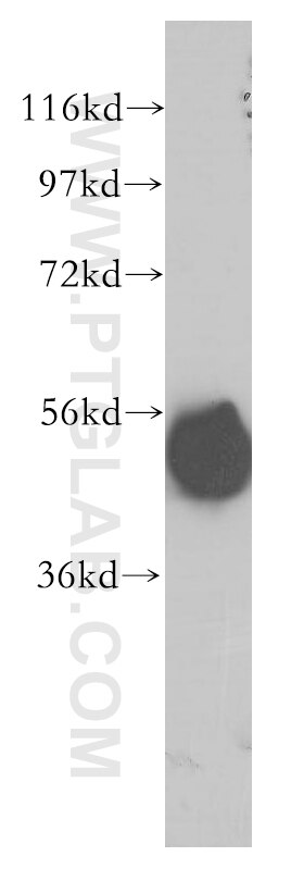Western Blot (WB) analysis of human liver tissue using CPVL Polyclonal antibody (12548-1-AP)