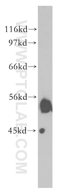 Western Blot (WB) analysis of HepG2 cells using CPVL Polyclonal antibody (12548-1-AP)