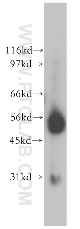 Western Blot (WB) analysis of human kidney tissue using CPVL Polyclonal antibody (12548-1-AP)