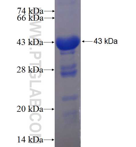CPVL fusion protein Ag3398 SDS-PAGE