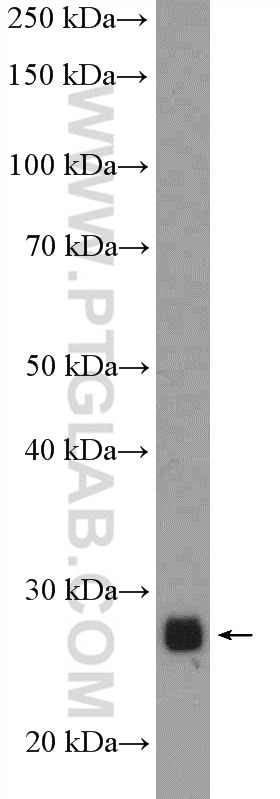 Western Blot (WB) analysis of human skeletal muscle tissue using CPXCR1 Polyclonal antibody (26005-1-AP)