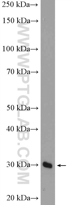 WB analysis of mouse liver using 26005-1-AP