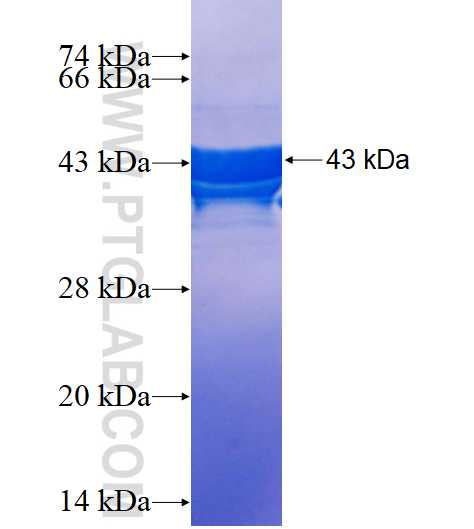CPXM2 fusion protein Ag15563 SDS-PAGE