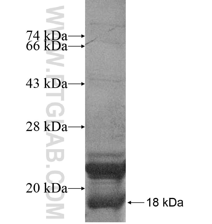 CPXM2 fusion protein Ag16626 SDS-PAGE