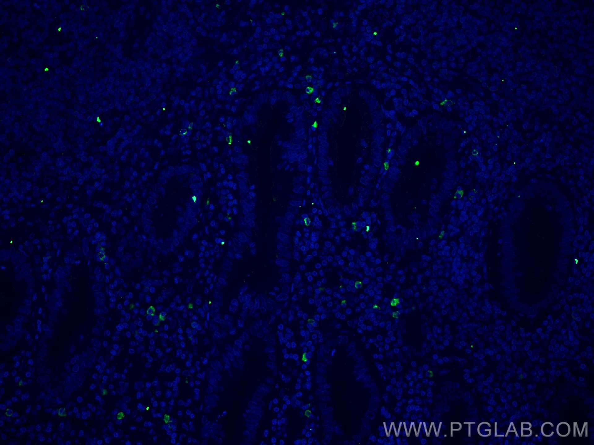 Immunofluorescence (IF) / fluorescent staining of human appendicitis tissue using CD35 Monoclonal antibody (68033-1-Ig)