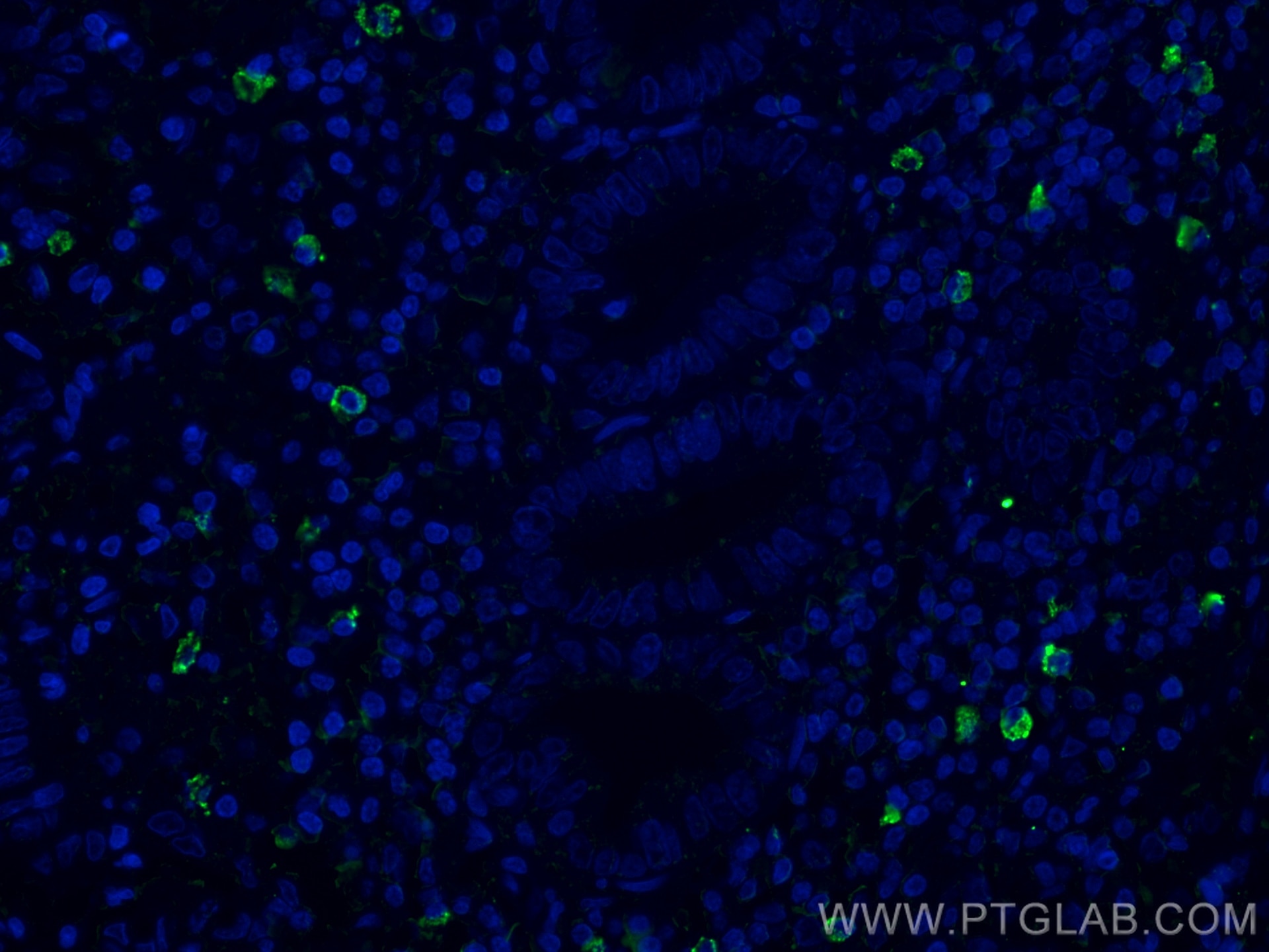Immunofluorescence (IF) / fluorescent staining of human appendicitis tissue using CR1 Monoclonal antibody (68033-1-Ig)