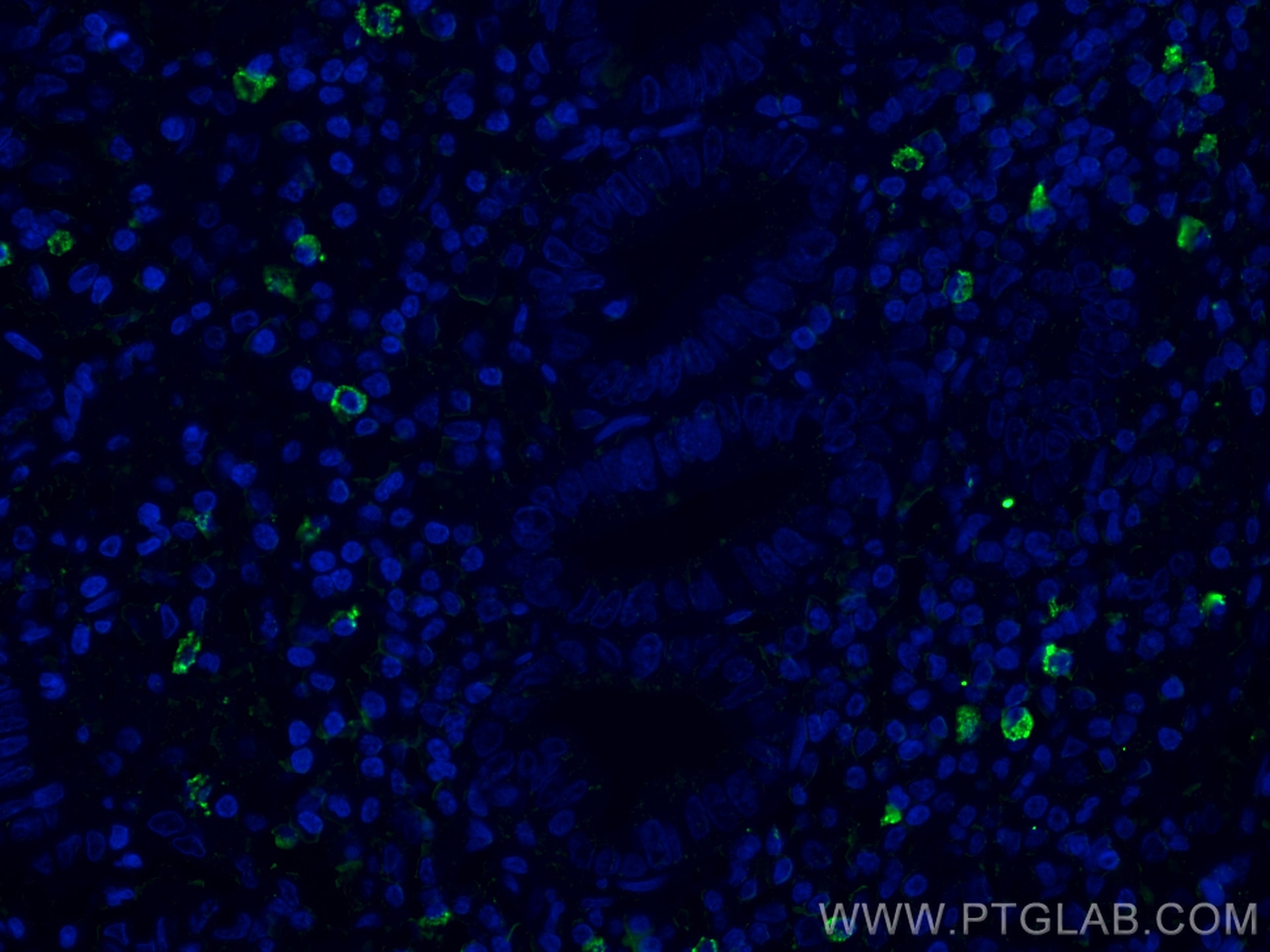 Immunofluorescence (IF) / fluorescent staining of human appendicitis tissue using CD35 Monoclonal antibody (68033-1-Ig)