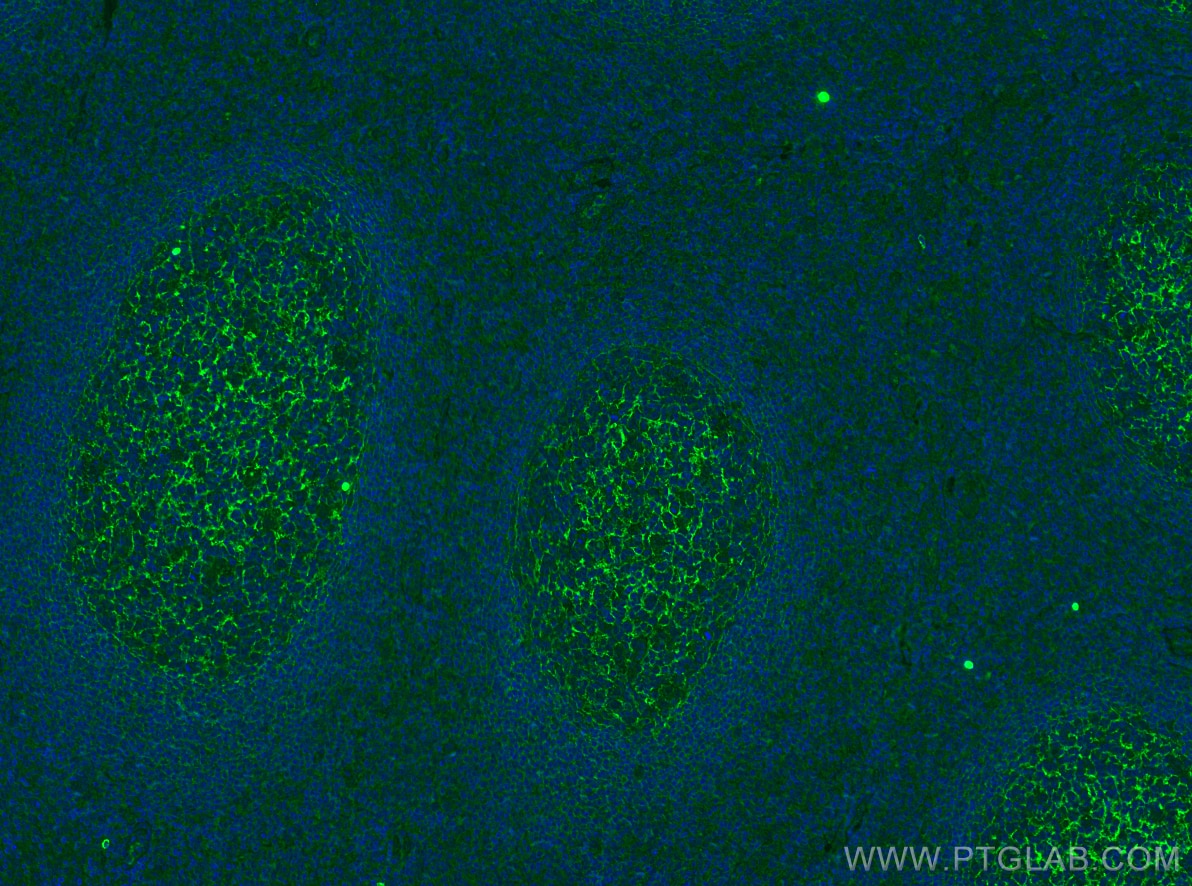 Immunofluorescence (IF) / fluorescent staining of human tonsillitis tissue using CD35 Monoclonal antibody (68033-1-Ig)