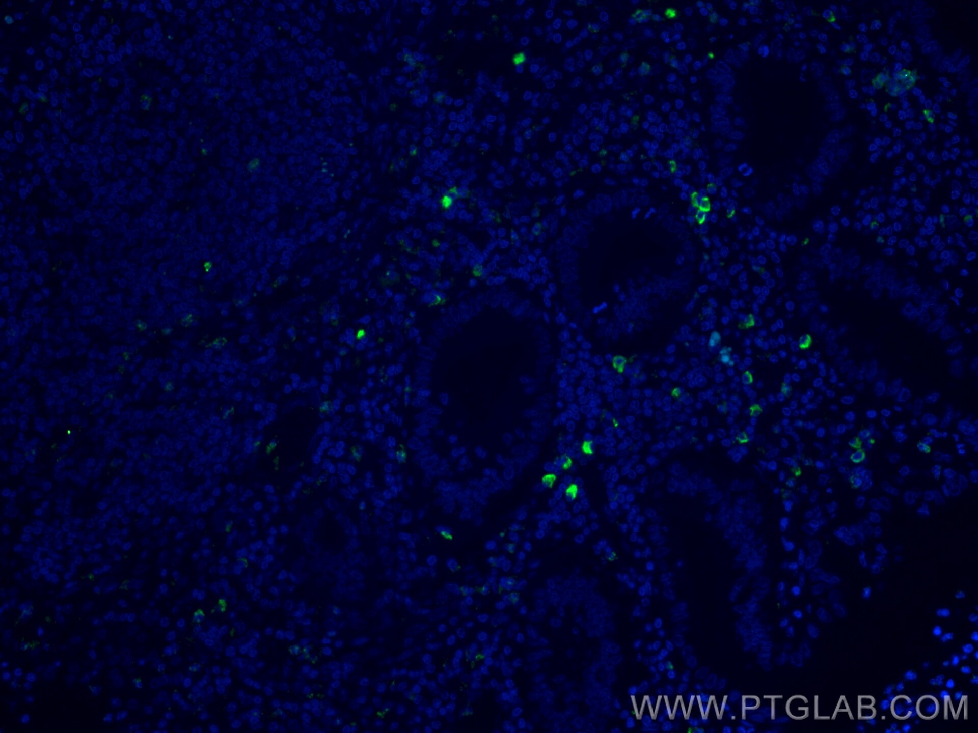 Immunofluorescence (IF) / fluorescent staining of human appendicitis tissue using CoraLite® Plus 488-conjugated CD35 Monoclonal anti (CL488-68033)
