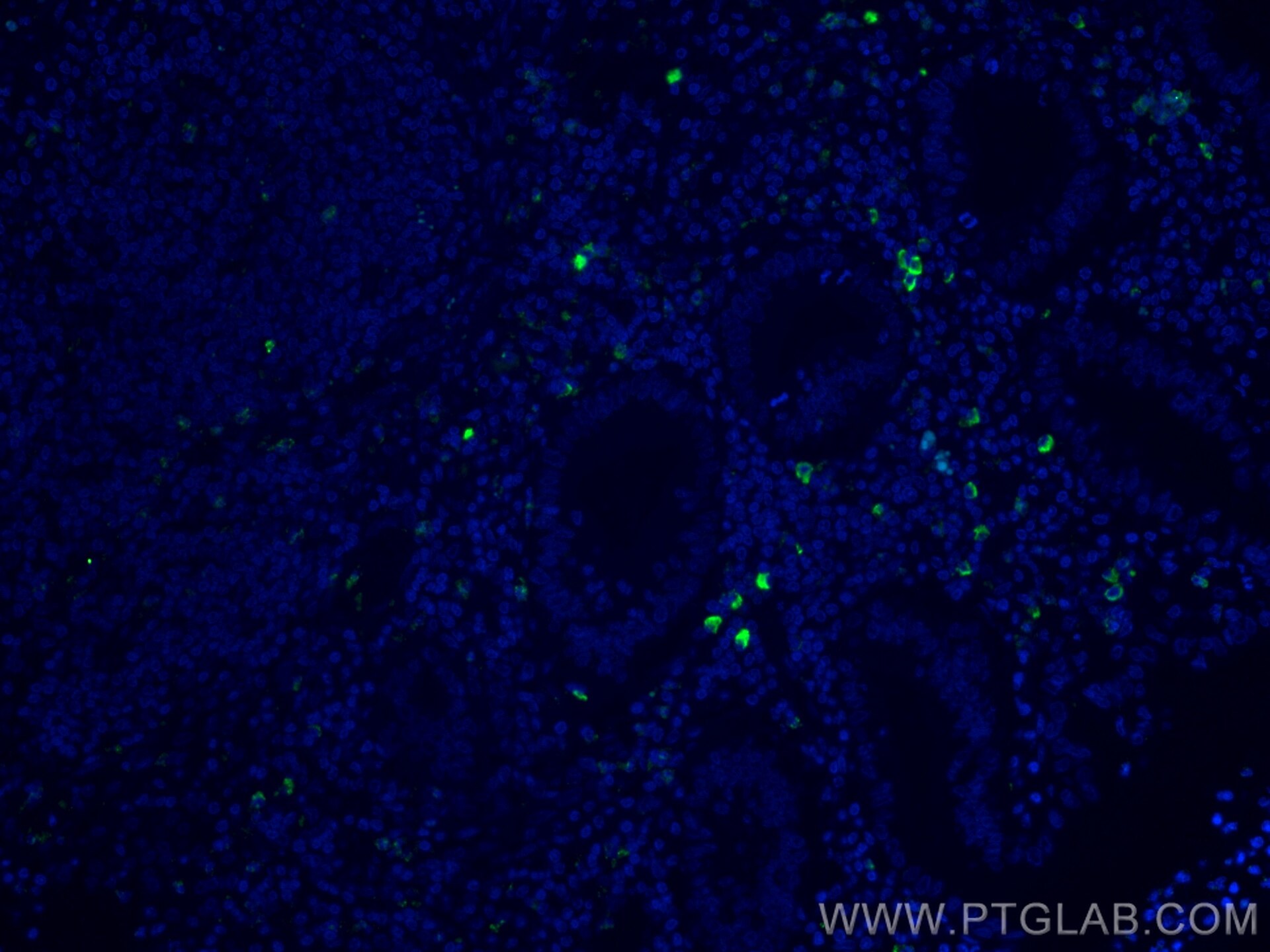 Immunofluorescence (IF) / fluorescent staining of human appendicitis tissue using CoraLite® Plus 488-conjugated CD35 Monoclonal anti (CL488-68033)