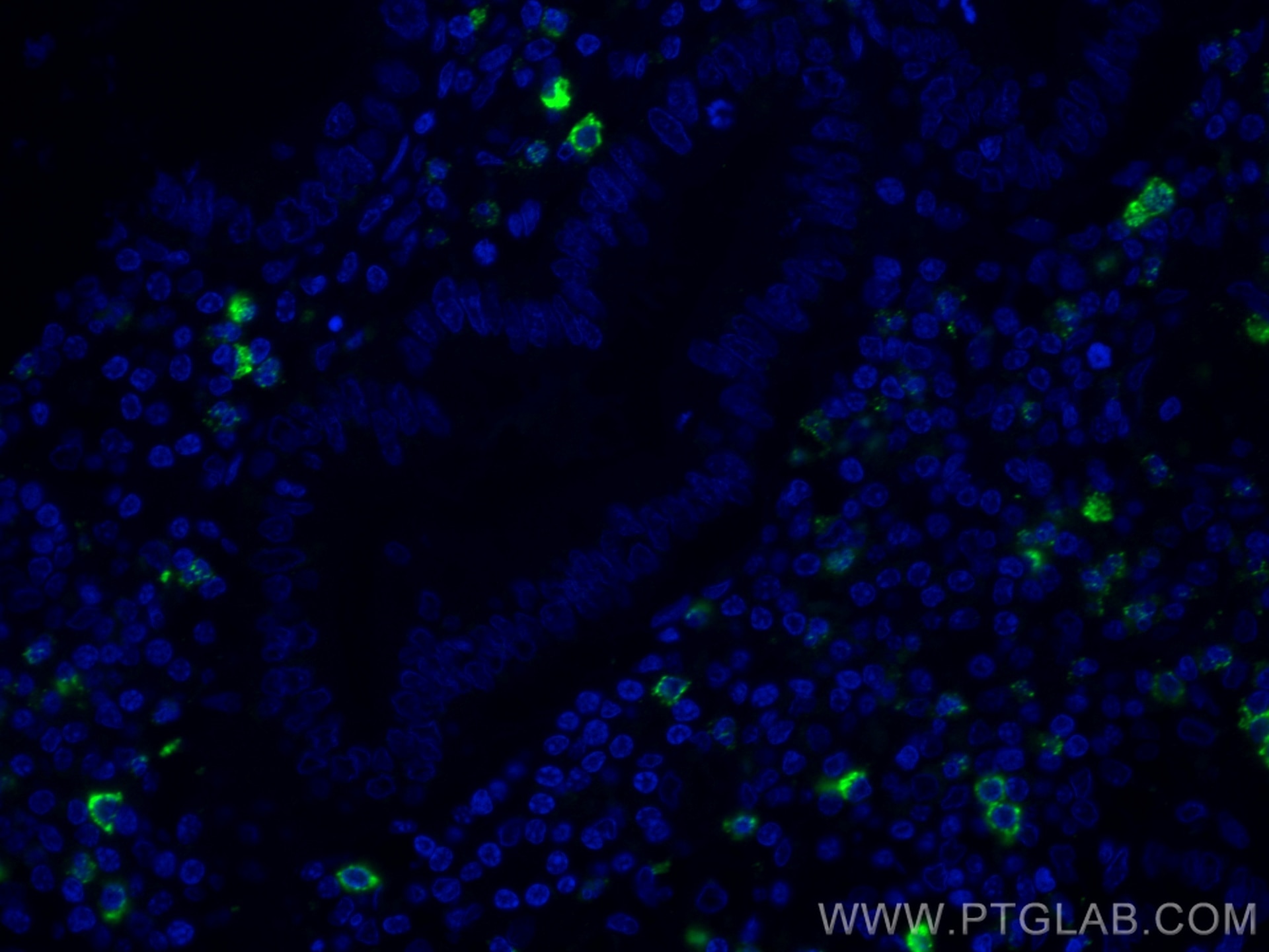 Immunofluorescence (IF) / fluorescent staining of human appendicitis tissue using CoraLite® Plus 488-conjugated CD35 Monoclonal anti (CL488-68033)
