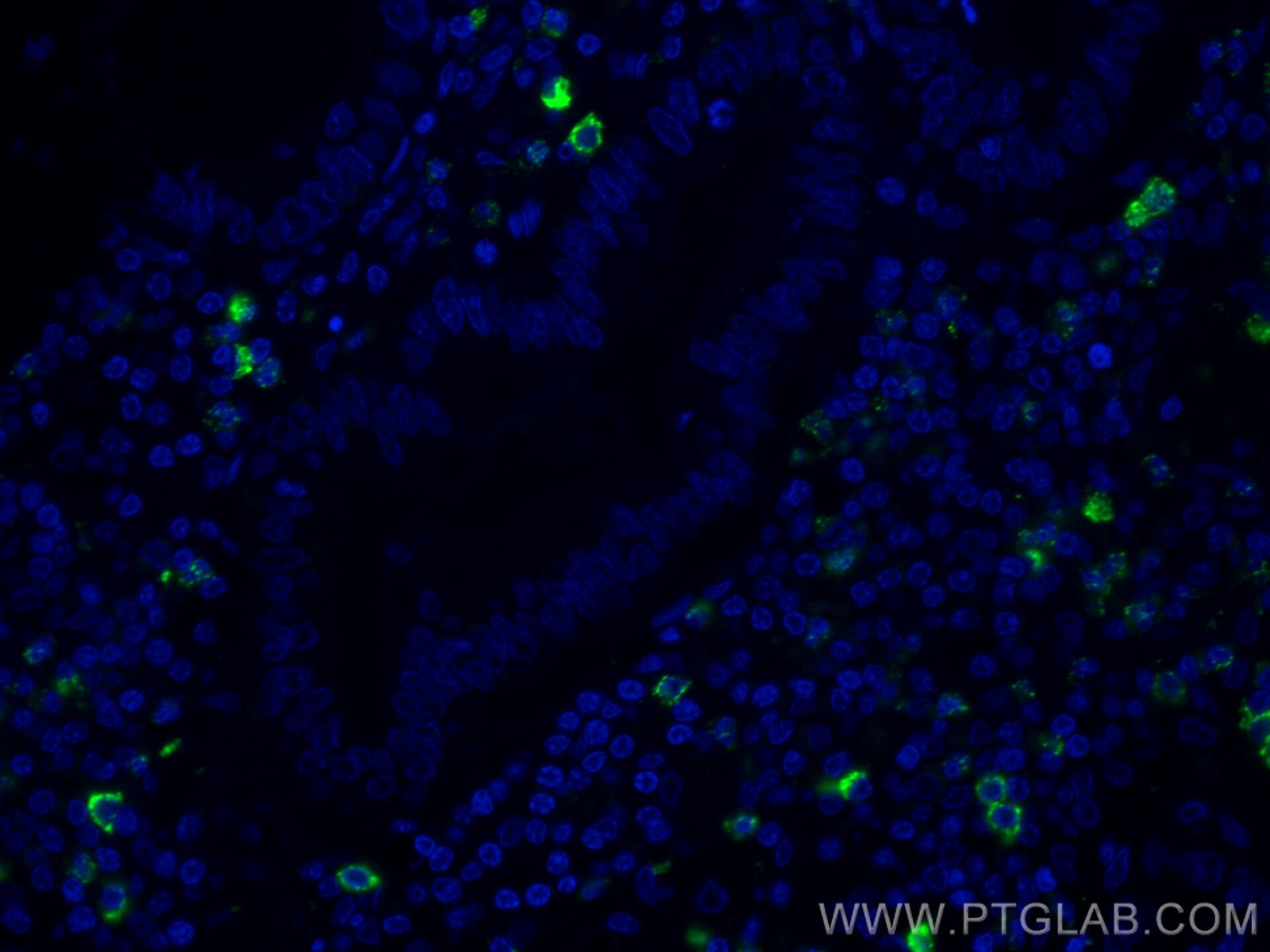 IF Staining of human appendicitis using CL488-68033