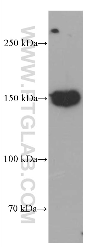 Western Blot (WB) analysis of human spleen tissue using CD21 Monoclonal antibody (66701-1-Ig)