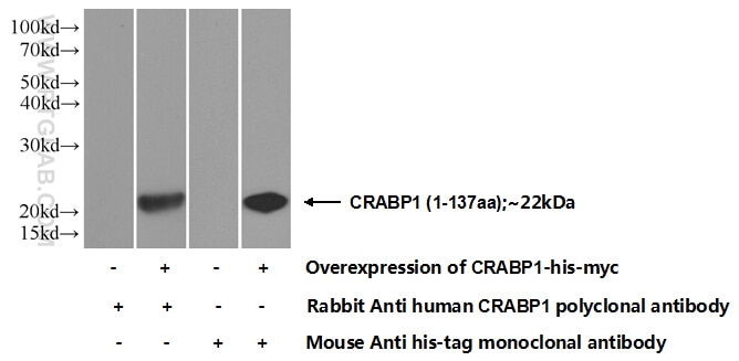 Western Blot (WB) analysis of Transfected HEK-293 cells using CRABP1 Polyclonal antibody (12588-1-AP)