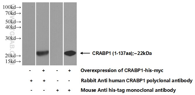 WB analysis of Transfected HEK-293 using 12588-1-AP