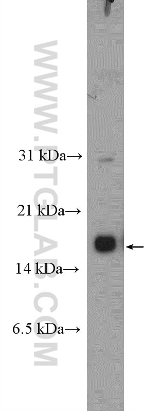 Western Blot (WB) analysis of mouse embryo tissue using CRABP1 Polyclonal antibody (12588-1-AP)