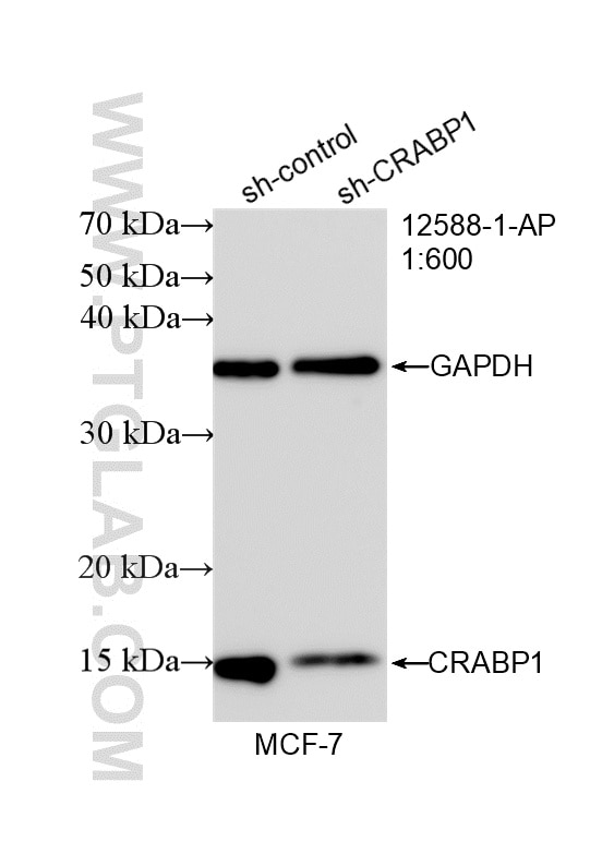 Western Blot (WB) analysis of MCF-7 cells using CRABP1 Polyclonal antibody (12588-1-AP)